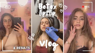 botox lip flip mini vlog  everyday results and side effects  is it better than lip fillers 🤫 [upl. by Noll]