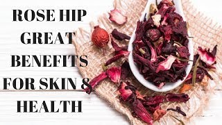 Incredible Skin amp Health Benefits of Rosehip Tea [upl. by Ettezoj]