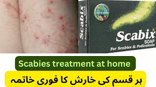 Scabix soap uses in Urdu scabies treatment at home scabix soap  pediculosis [upl. by Ennaxor102]