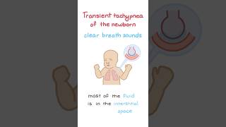 Transient tachypnea of the newborn TTN [upl. by Black]