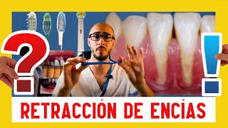 ✅ Como detener la retracción de las encías  ⚠️TIPS amp SKILLS⚠️ [upl. by Eihtur]