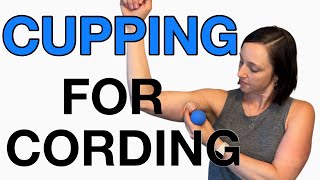 How to do CUPPING for CORDING after Breast Cancer Surgery Axillary Web Syndrome [upl. by Ettenyl]