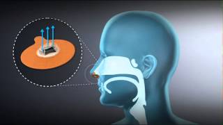 Getting Started with Provent Sleep Apnea Therapy [upl. by Uchish]