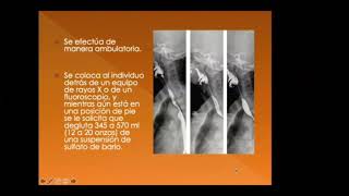 Clase de Serie Gastroduodenal [upl. by Brad249]