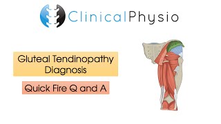 Classic Gluteal Tendinopathy Diagnosis  Clinical Physio [upl. by Nyltiac267]