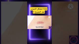 اكتشف فوائد الزنجبيل في علاج الأمراض الجلدية [upl. by Selrac]