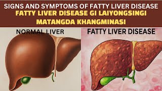 Fatty Liver Disease gi Laiyongsingi Matangda Khangminasi Manipuri [upl. by Ashby]