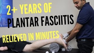 2 Years of Plantar Fasciitis Relieved In Minutes REAL TREATMENT [upl. by Zina256]