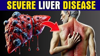 11 Strange Signs of LIVER DAMAGE Healthy Care [upl. by Arzed123]