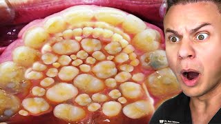 Orthodontist Reacts To Horrifying Dental TikToks [upl. by Sanjiv586]