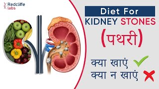 ✅ Diet for Kidney stones in Hindi  किडनी स्टोन में भूल से भी नहीं खाएं ये चीजें  Kidney Stone Diet [upl. by Thorndike838]