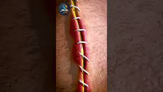 🤯Unbelievable Wound Healing3d animation shorts [upl. by Rosenbaum]