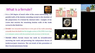 Managing of Insufficient Ferrule Effect [upl. by Aizitel922]