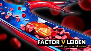 Factor V Leiden Everything You Need To Know [upl. by Hansel]