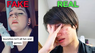 Guy with Real Tourettes Reacts to Tiktoker Faking Tourettes [upl. by Aja13]