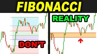 I Tested The Best Supertrend Indicator Strategy For Beginners 100 Times  Im Shocked [upl. by Wesley895]