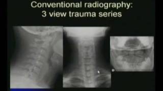 Cervical Spine AP View [upl. by Alrep]