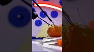 How laparoscopic surgery are done shortsvideo [upl. by Nawaj]