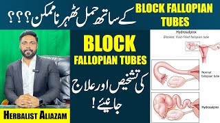 Fallopian Tubes Blockage  Causes amp Symptoms  Get Pregnant With Blocked Tubes  EhtishamJanjua [upl. by Janine41]