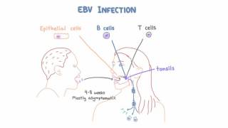 EBV and Mononucleosis  Pathogenesis and Clinical Presentation [upl. by Veator]