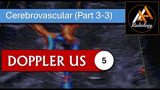 5  Cerebrovascular System Part 33 [upl. by Nash]