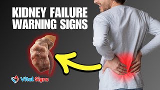 Uncommon Kidney Failure Symptoms You Shouldn’t Ignore  Early Warning Signs amp Prevention Tips [upl. by Binnie]