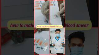 Blood smear preparation  Peripheral smear medical viral shorts youtubeshorts [upl. by Mima]