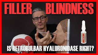 FILLER BLINDNESS Should you do retrobulbar hyaluronidase injection Aesthetics Mastery Show [upl. by Ramsey]