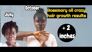 How To use Rosemary Oil For Hair Growth  Before and After Results 4C Hair [upl. by Brice]