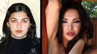 Shorena Begashvili Before  After Plastic Surgery [upl. by Gnet31]