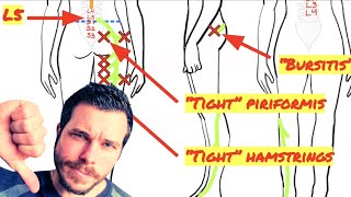 Trigger Point Release for Piriformis Muscle Not Working [upl. by Yleen660]