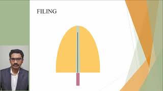 INFODONTICS  S01 E08  Endodontics simplified  Hand filing techniques [upl. by Aicnatsnoc]