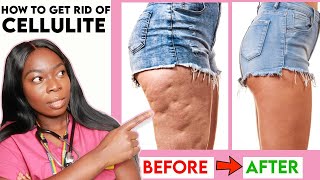 How to get rid of CELLULITE on your THIGHS LEGS amp BUTT Home Remedies Workout  Creams amp more [upl. by Nolram]