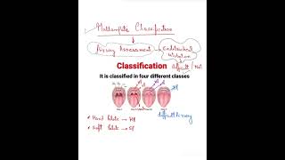 Mallampati classificationanesthesia Fmge Important topic spot [upl. by Annair]