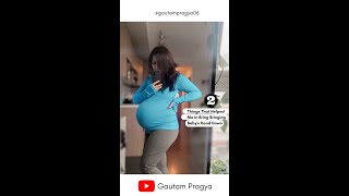 🤘 How To Bring BABYS HEAD DOWN with these 2 simple exercises shorts [upl. by Childers317]