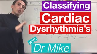 Cardiac dysrhythmias arrhythmias common [upl. by Darren]