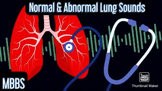 Normal amp Abnormal Lung sounds Wheeze Rhonchi Crepitus Stridor mbbs medicine neetpg [upl. by Frasquito]