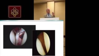 Stanmore Classification for Shoulder Instability by Ian Bayley January 2014 [upl. by Ardnnek2]