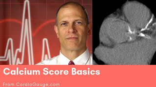 Calcium Score Basics What the Calcium Score is and how you can use it to understand your risks [upl. by Staci812]