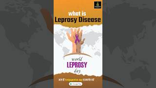 Leprosy  Leprosy Cause Symptoms Treatment Prevention Leprosy In Hindi Leprosy shorts nursing [upl. by Maddalena]