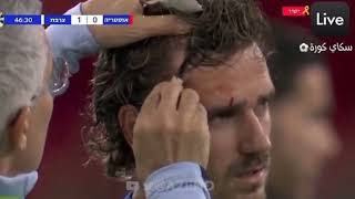 🇫🇷 Frances Antoine Griezmann bleeding after painfully colliding with advertising board vs Austria [upl. by Oilenroc]