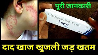 Lucoz cream Uses in hindi  Luliconazole Cream Uses in hindi [upl. by Greenfield]