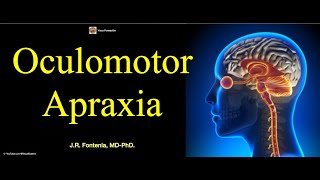 Oculomotor Apraxia [upl. by Ranson]