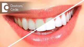 Teeth cleaning vs teeth whitening  Dr Sumanth M Shetty [upl. by Esinrahc]