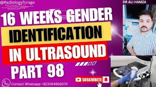 Gender Identification Male or Female In Ultrasound  Part 98  In 16 Weeks [upl. by Arihk]