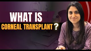 What is Corneal Transplant Keratoplasty Surgery [upl. by Eladnar]