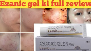 How To Transform Your Skin with Azelaic Acid The Secret to Clear Glowing Skin  Dr Sam Bunting [upl. by Nosredna]