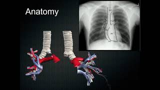 Mastering Medicine series Chest Xrays [upl. by Anilehcim]