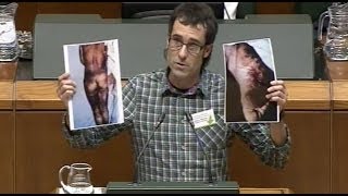 Julen Arzuaga pregunta al PPPSOE quot¿Esto es una autolesión fingida del manual de torturas quot [upl. by Fraser209]