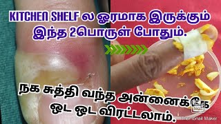 நக சுத்தி வலியில்லாமல் குணமாக்க இது போதுங்கhow to cure paronychia at home remedy [upl. by Nalid376]